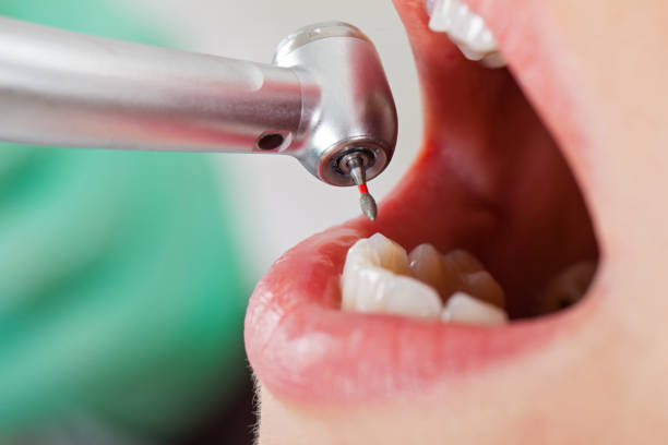 Best Emergency Tooth Extraction in West Wyoming, PA